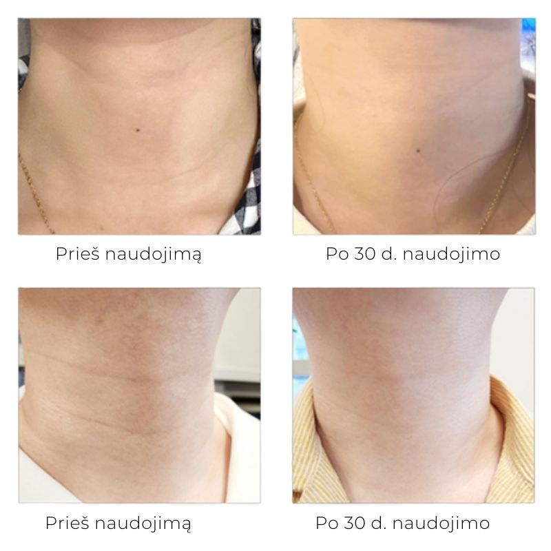 Arocell Super Neck Cream – kaklo kremas su niacinamidu, 80 g Arocell Super Neck Cream – kaklo kremas su niacinamidu, 80 g